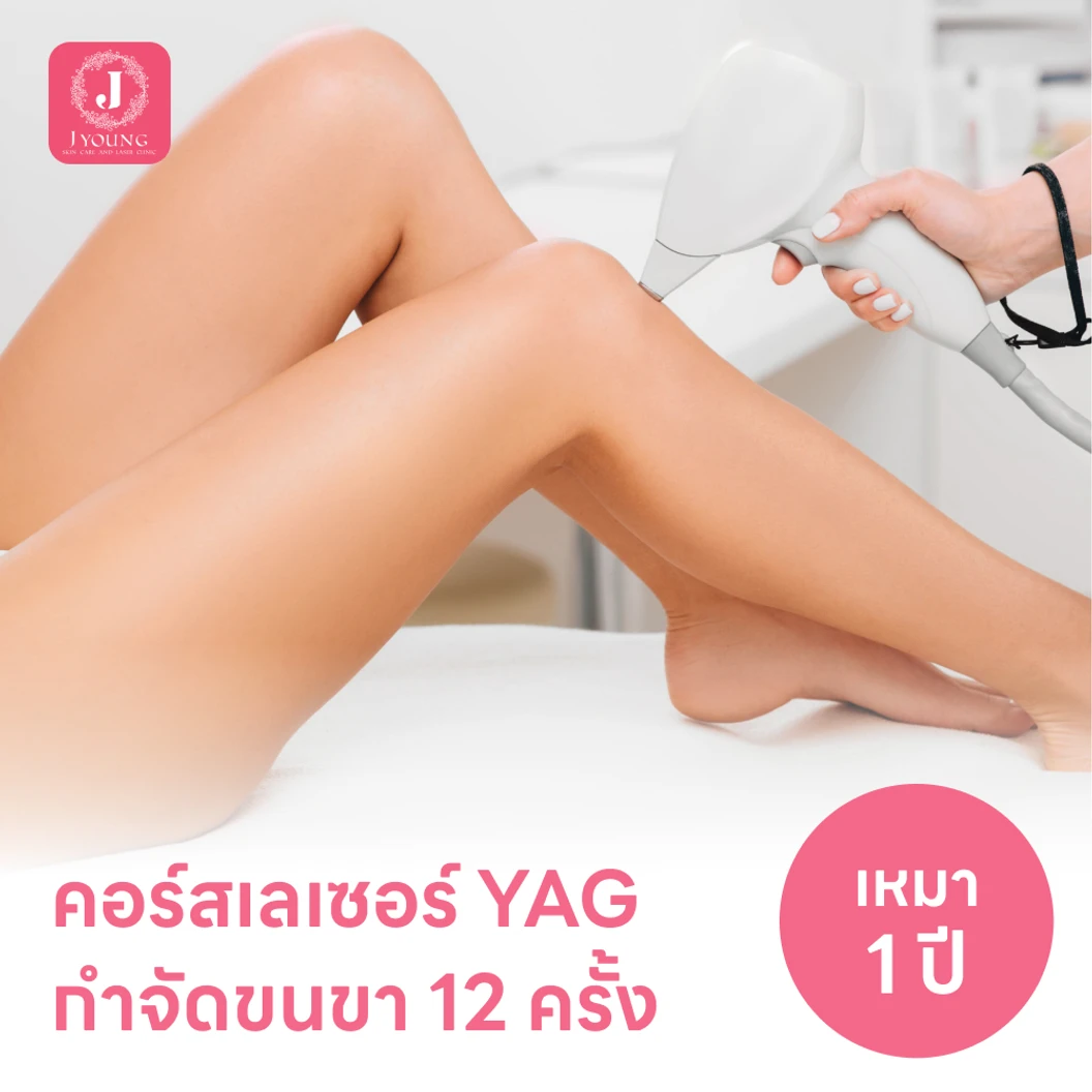 คอร์สเลเซอร์กำจัดขนขา 12 ครั้ง ด้วย YAG Laser
