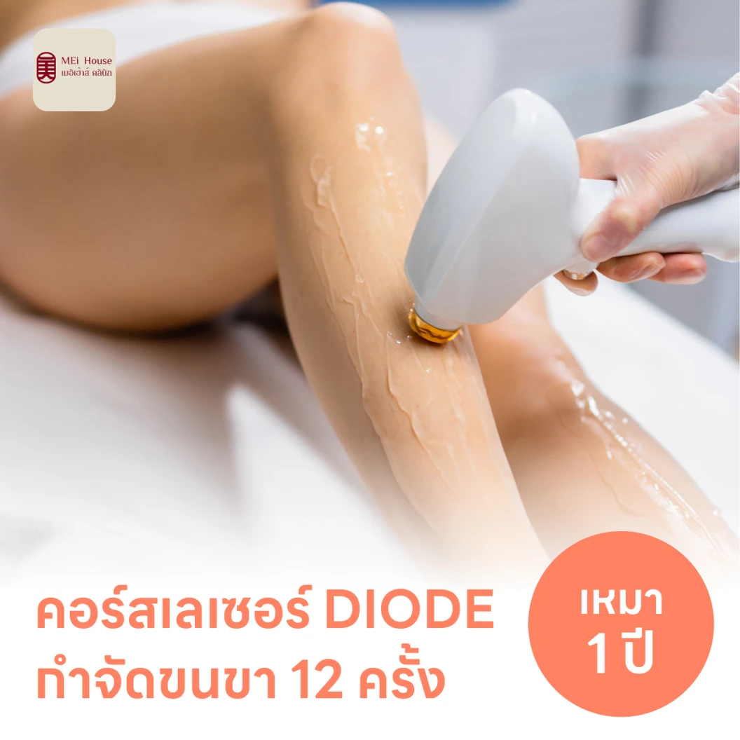 คอร์สเลเซอร์กำจัดขนทั่วขา 12 ครั้ง ด้วย Diode Laser