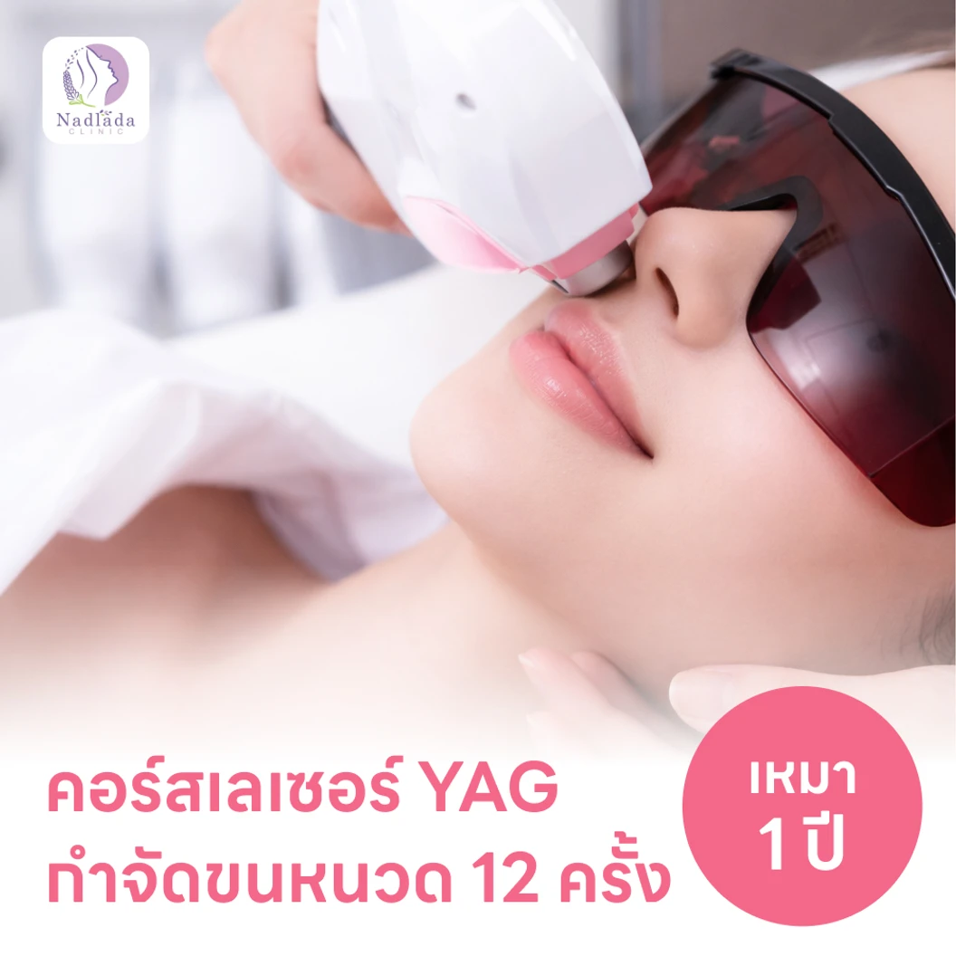 คอร์สเลเซอร์กำจัดขนหนวด 12 ครั้ง ด้วย YAG Laser (ผู้หญิงเท่านั้น)