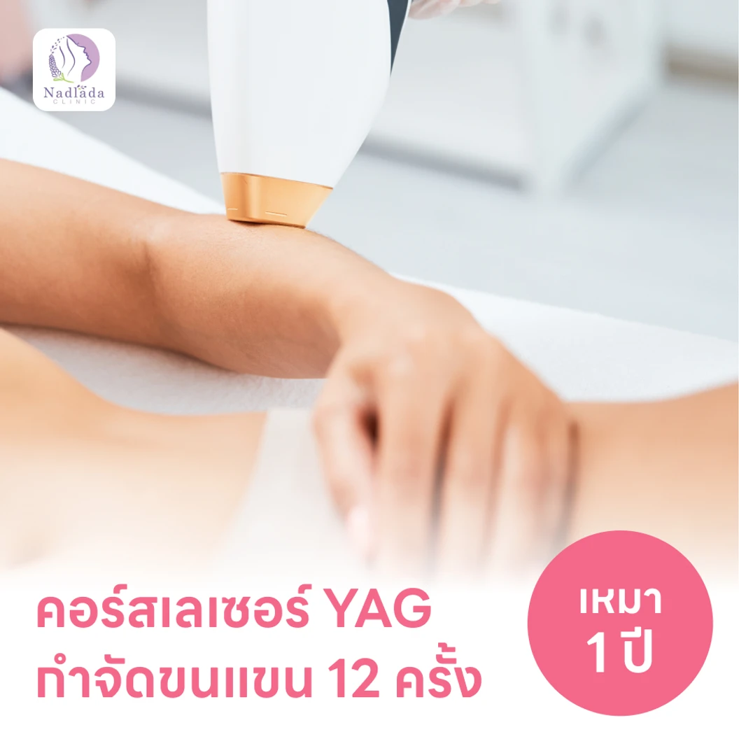 คอร์สเลเซอร์กำจัดขนแขน 12 ครั้ง ด้วย YAG Laser (ผู้หญิงเท่านั้น)