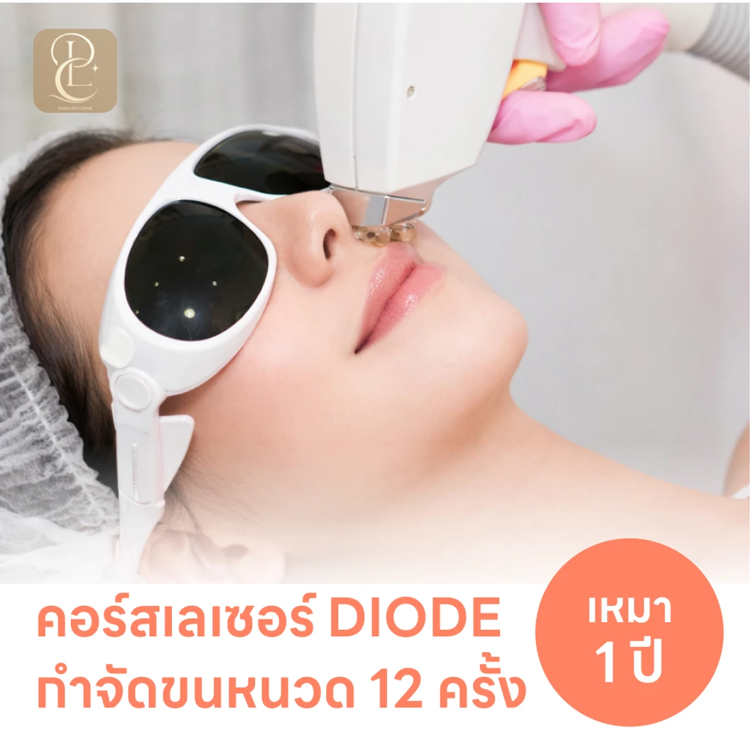 คอร์สเลเซอร์กำจัดขนหนวด 12 ครั้ง ด้วย Diode Laser