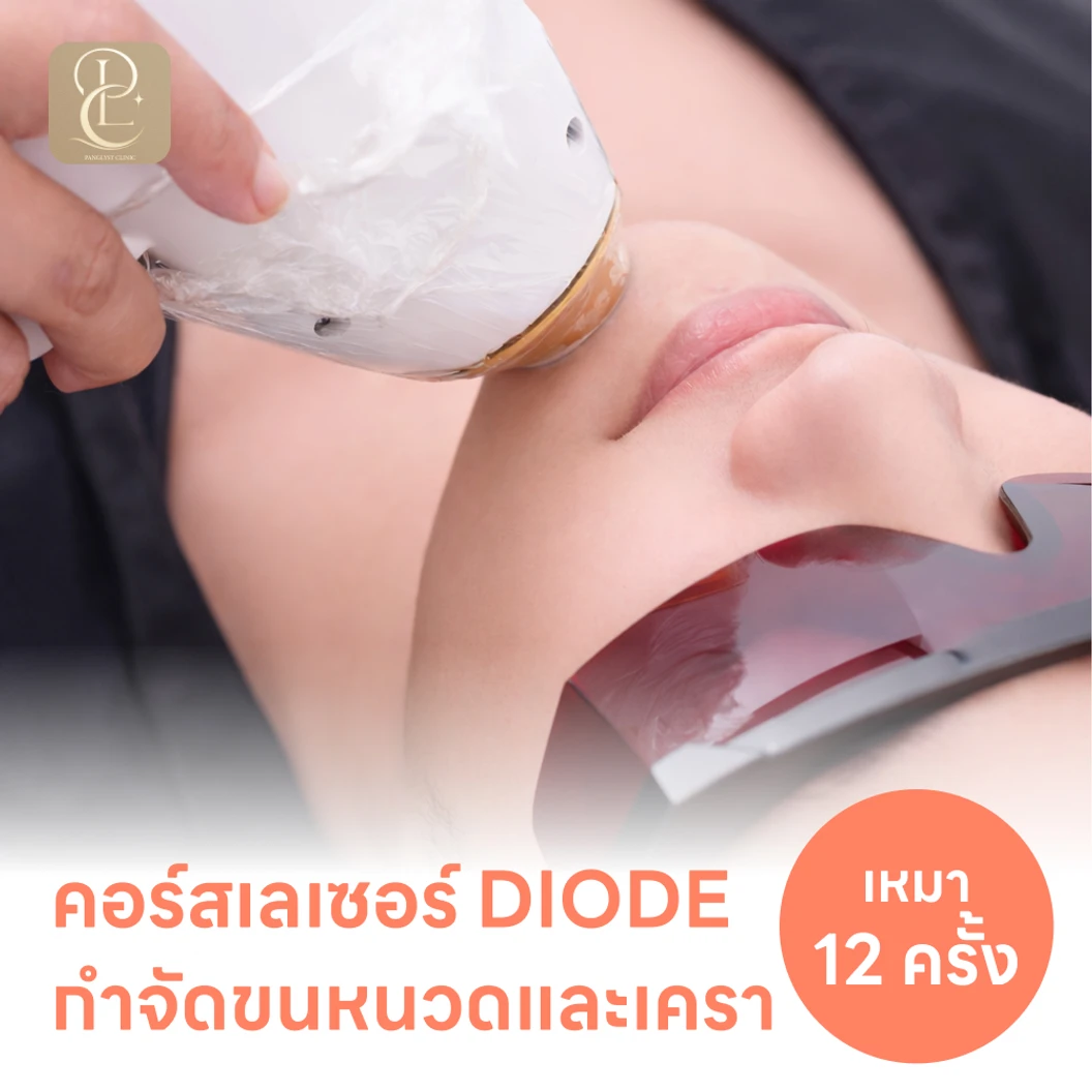 คอร์สเลเซอร์กำจัดขนหนวดและเครา 12 ครั้ง ด้วย Diode Laser