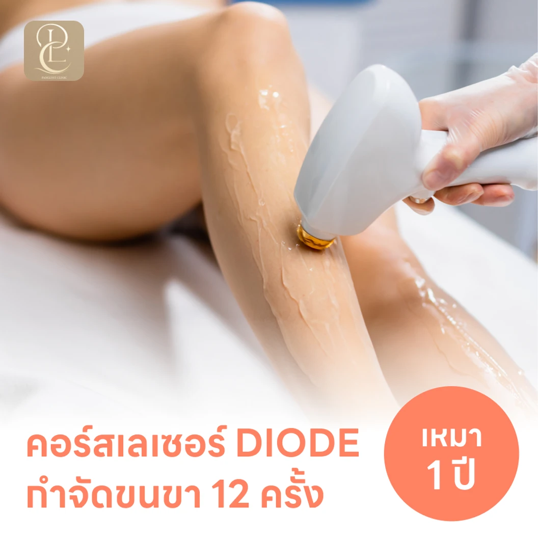 คอร์สเลเซอร์กำจัดขนทั่วขา 12 ครั้ง ด้วย Diode Laser