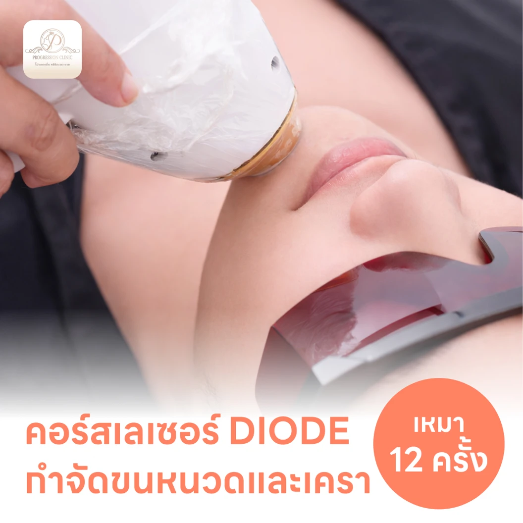 คอร์สเลเซอร์กำจัดขนหนวดและเครา 12 ครั้ง ด้วย Diode Laser