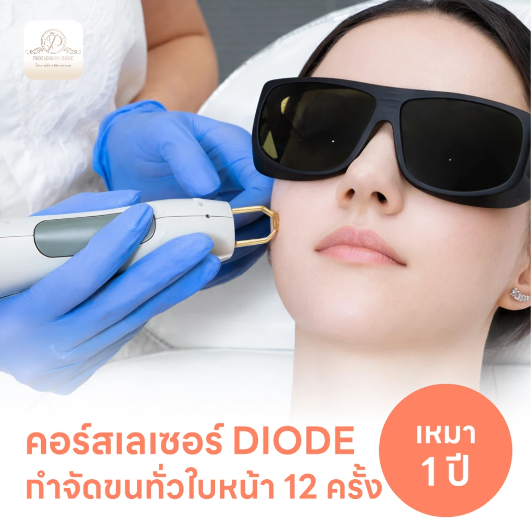 คอร์สเลเซอร์กำจัดขนทั่วหน้า 12 ครั้ง ด้วย Diode Laser