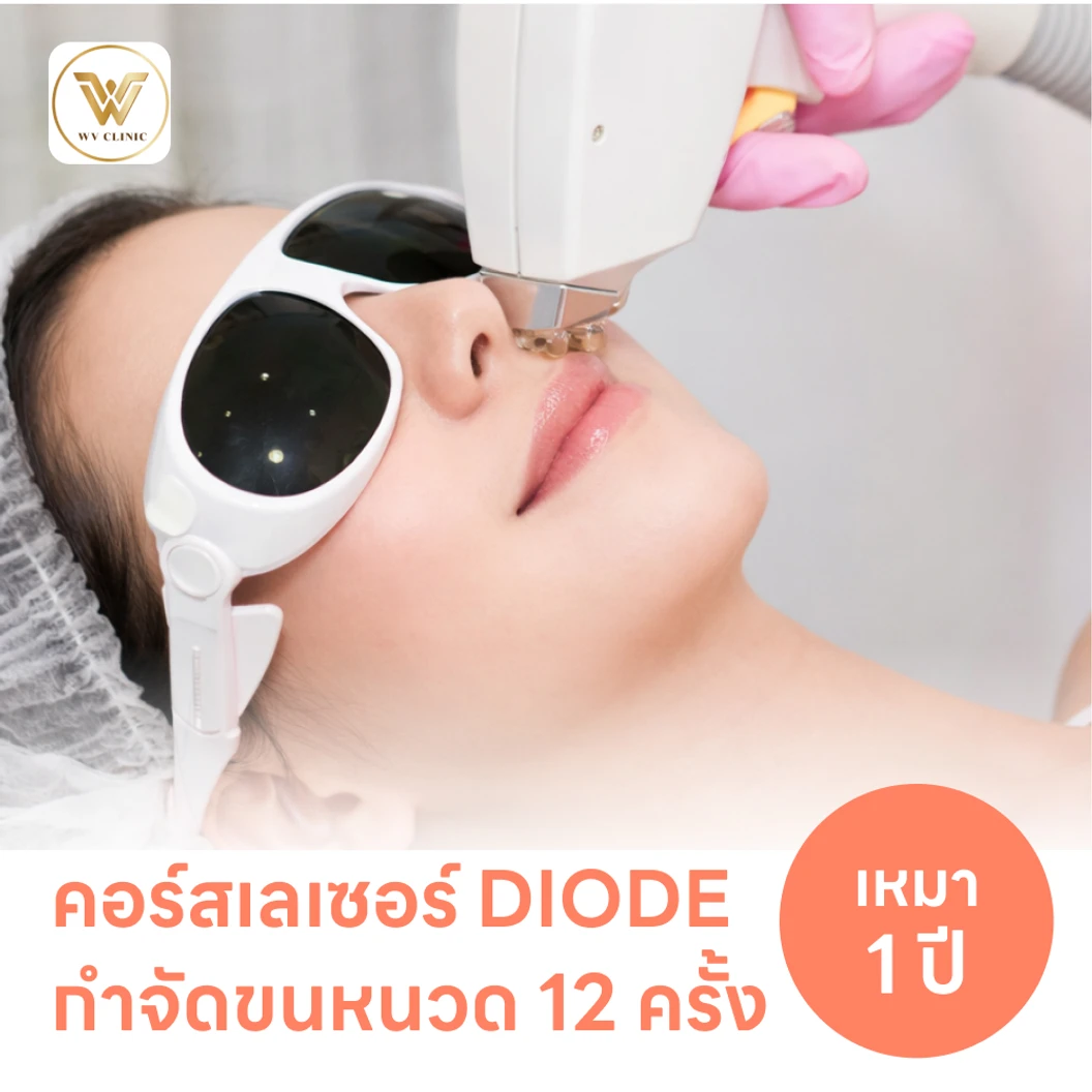 คอร์สเลเซอร์กำจัดขนหนวด 12 ครั้ง ด้วย Diode Laser