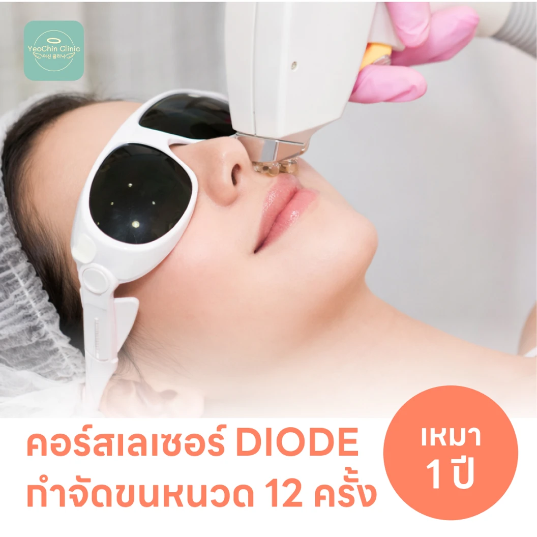 คอร์สเลเซอร์กำจัดขนหนวด 12 ครั้ง ด้วย Diode Laser