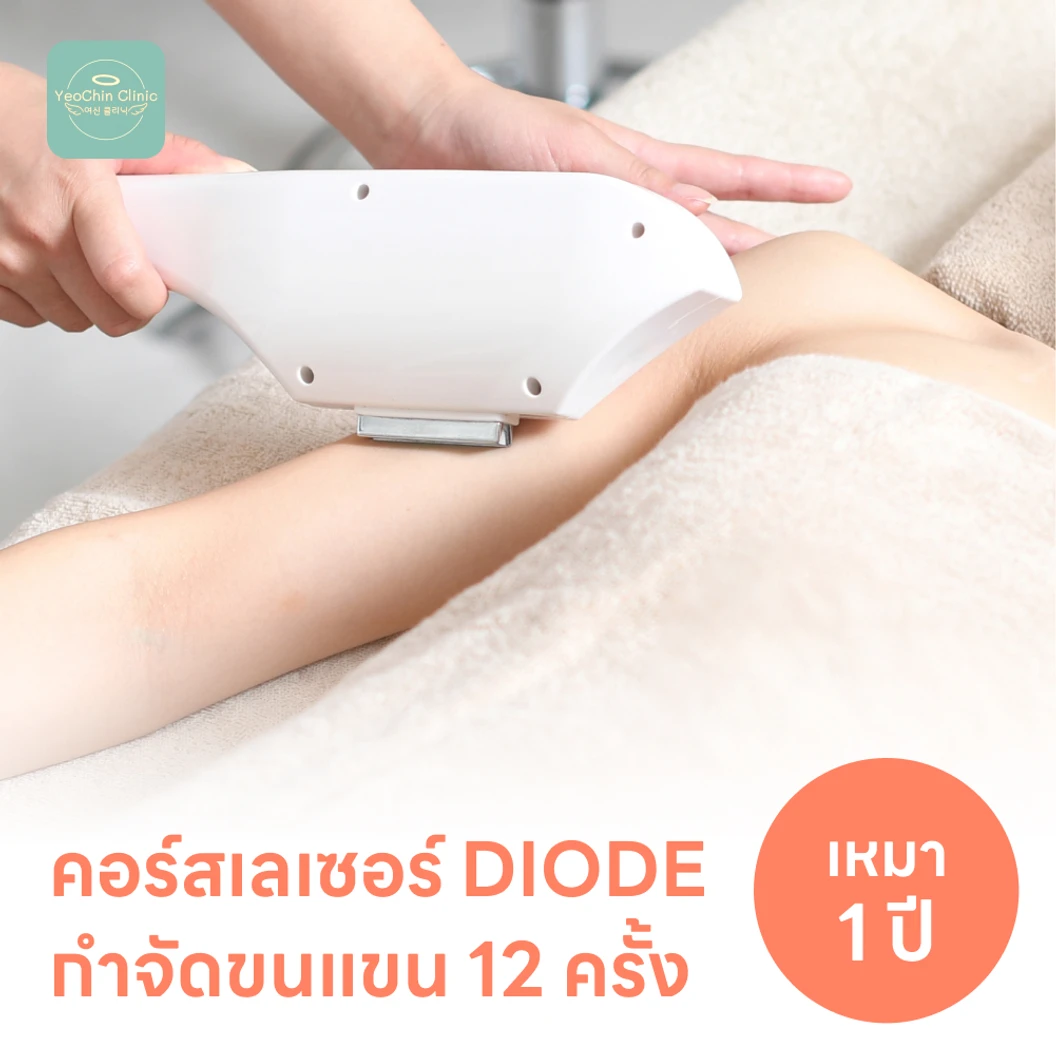 คอร์สเลเซอร์กำจัดขนทั่วแขน 12 ครั้ง ด้วย Diode Laser