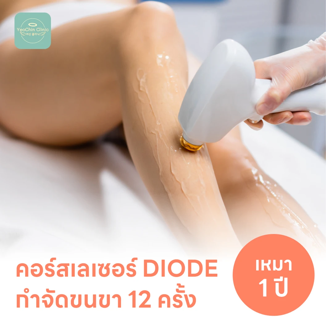 คอร์สเลเซอร์กำจัดขนทั่วขา 12 ครั้ง ด้วย Diode Laser