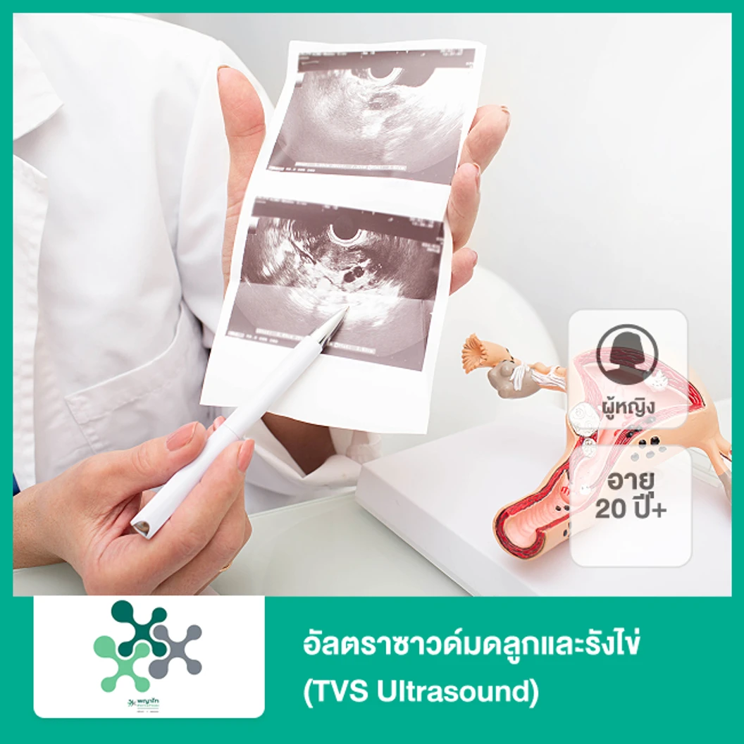 อัลตราซาวด์มดลูกและรังไข่ (TVS Ultrasound) (ผู้หญิง 20 ปีขึ้นไป)