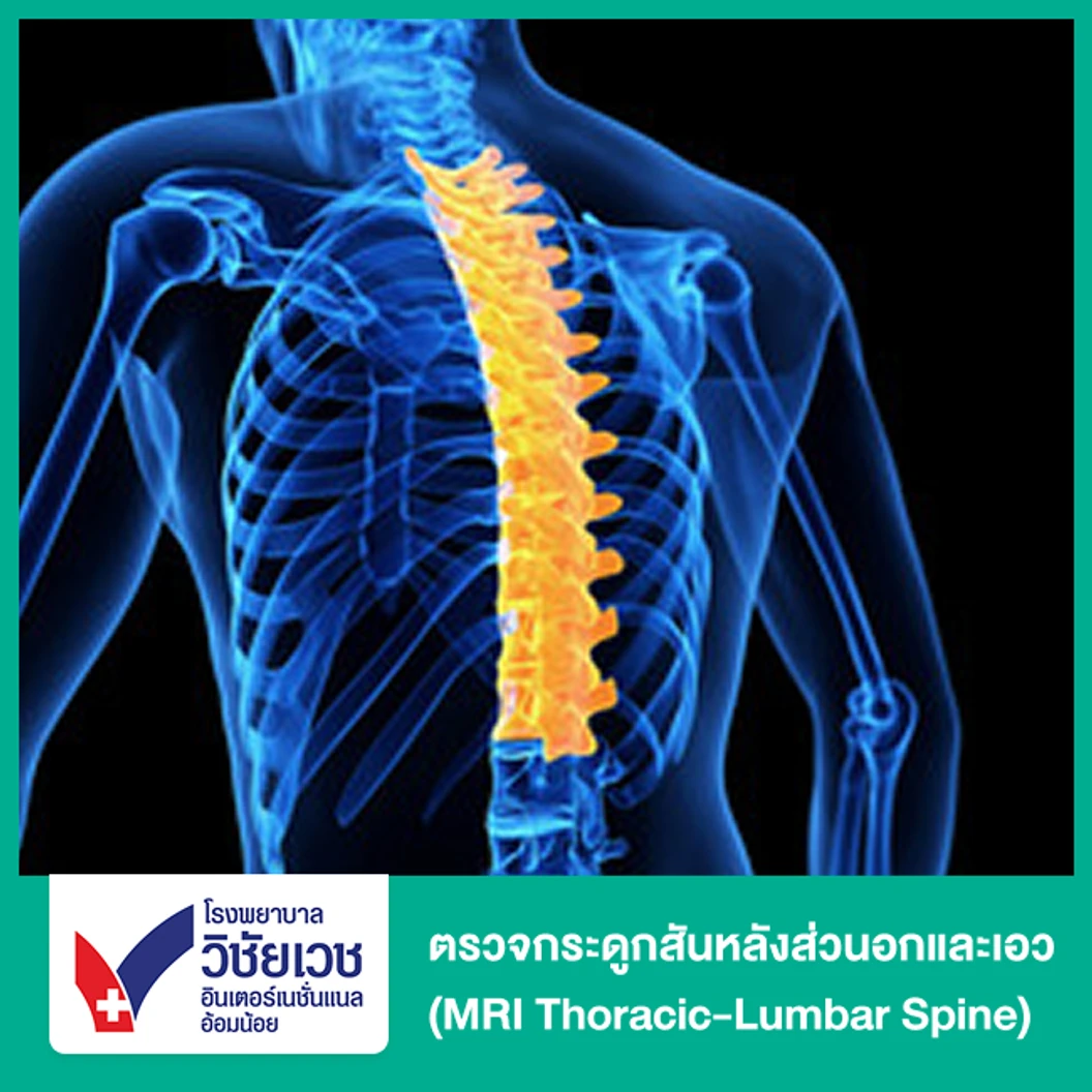 ตรวจกระดูกสันหลังส่วนอกและเอว ด้วยคลื่นแม่เหล็กไฟฟ้า (MRI Thoracic-Lumbar Spine) (ทุกช่วงวัย)