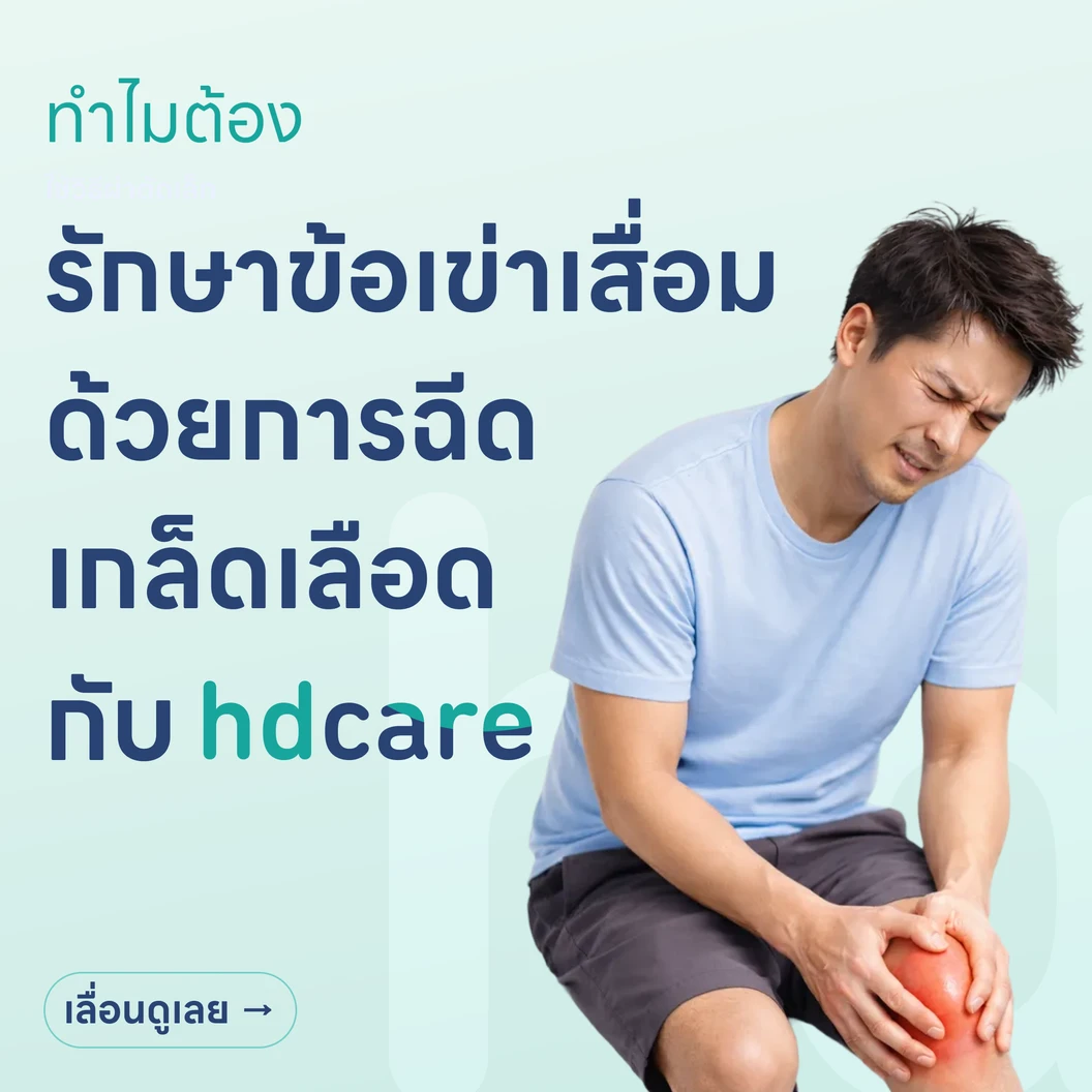 รักษาข้อเข่าเสื่อมด้วยการฉีดเกล็ดเลือดเข้มข้น