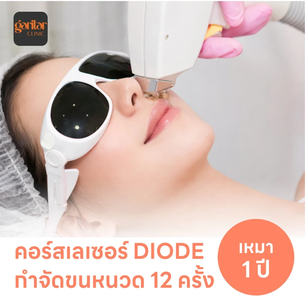 คอร์สเลเซอร์กำจัดขนหนวด 12 ครั้ง ด้วย Diode Laser