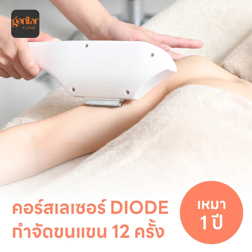 คอร์สเลเซอร์กำจัดขนทั่วแขน 12 ครั้ง ด้วย Diode Laser
