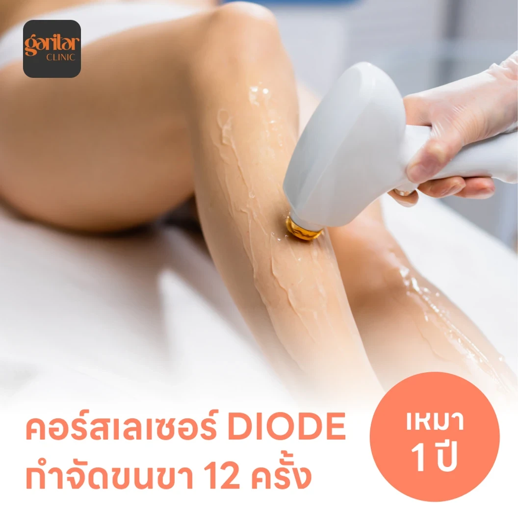 คอร์สเลเซอร์กำจัดขนทั่วขา 12 ครั้ง ด้วย Diode Laser