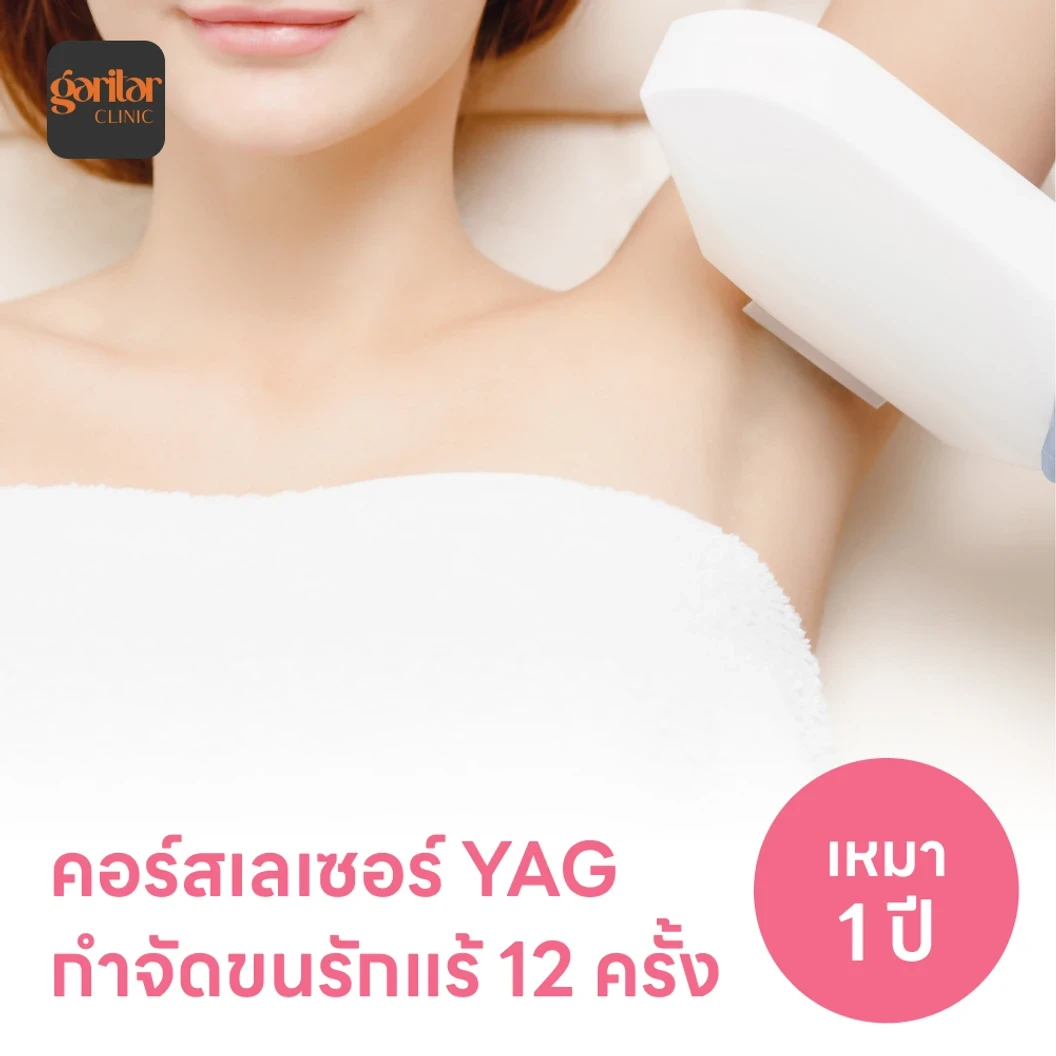 คอร์สเลเซอร์กำจัดขนรักแร้ 12 ครั้ง ด้วย YAG Laser