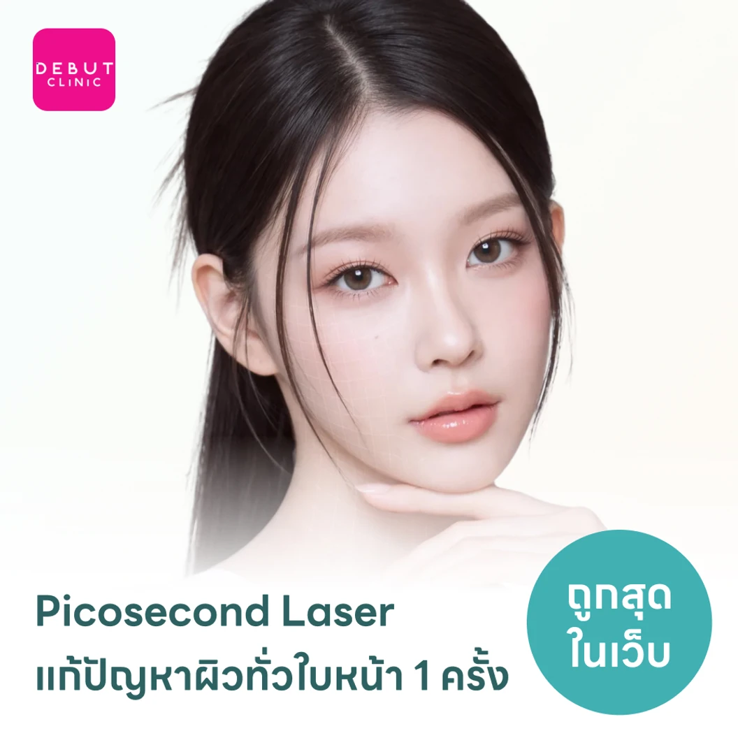 Picosecond Laser แก้ปัญหาผิวทั่วใบหน้า 1 ครั้ง จำกัด 1 ท่านต่อ 1 สิทธิ์ เท่านั้น