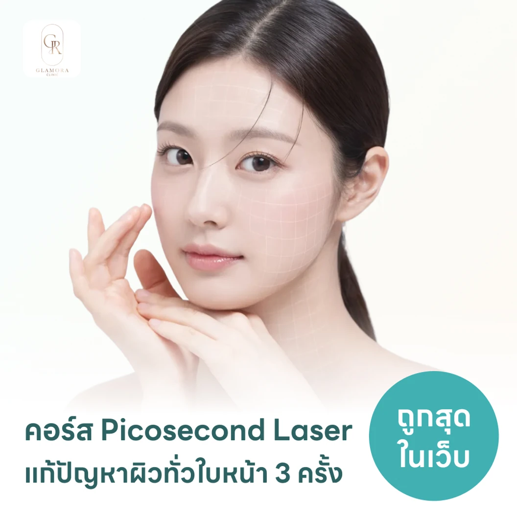 คอร์ส Picosecond Laser แก้ปัญหาผิวทั่วใบหน้า 3 ครั้ง