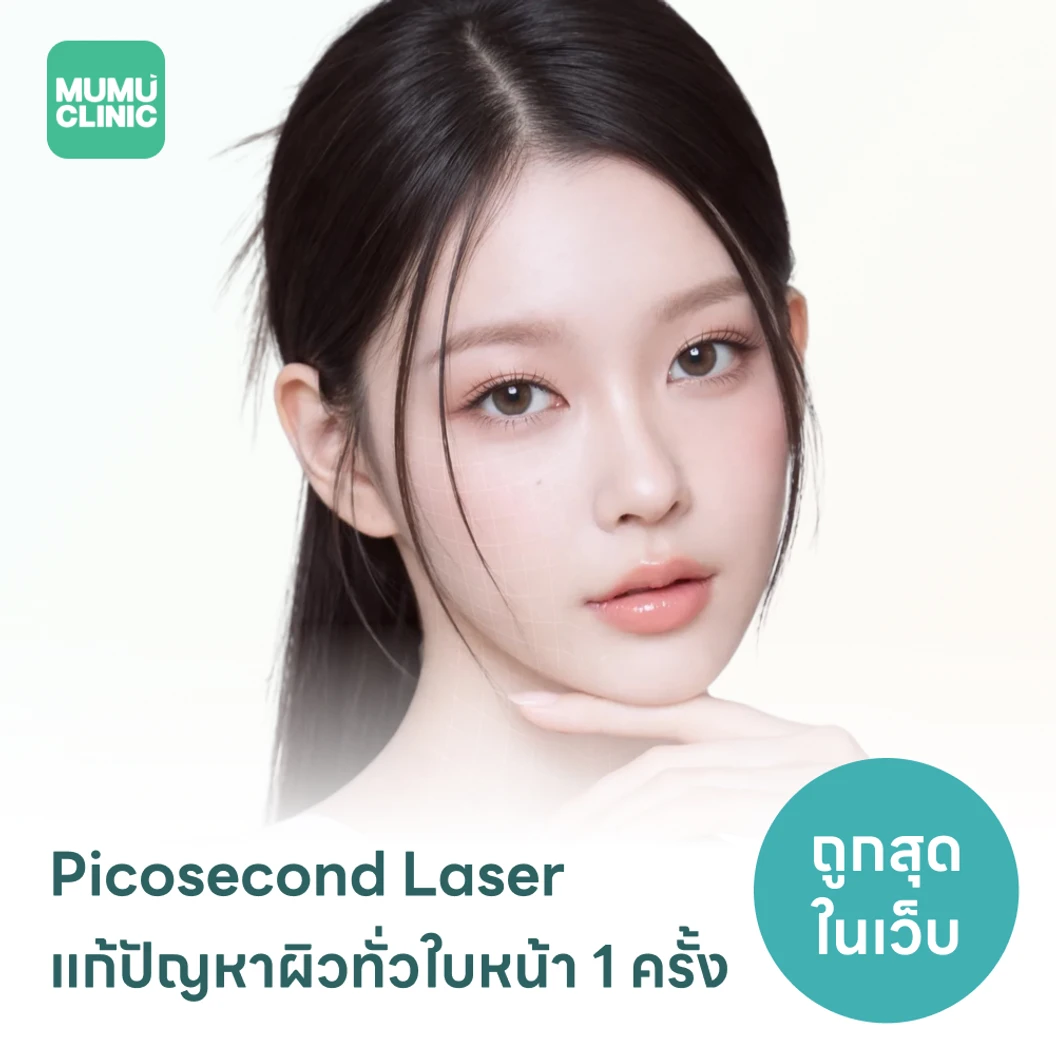 Picosecond Laser แก้ปัญหาผิวทั่วใบหน้า 1 ครั้ง จำกัด 1 ท่านต่อ 1 สิทธิ์ เท่านั้น