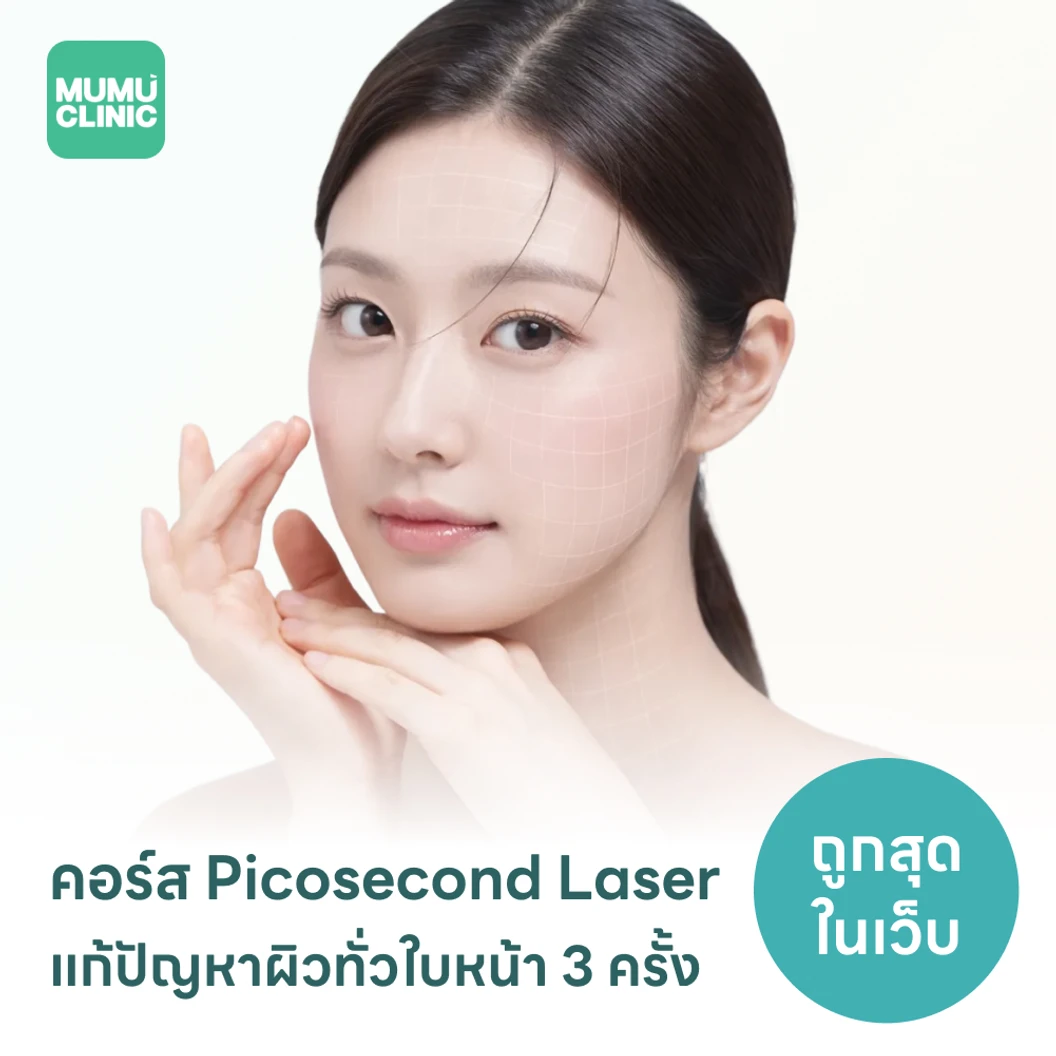 คอร์ส Picosecond Laser แก้ปัญหาผิวทั่วใบหน้า 3 ครั้ง