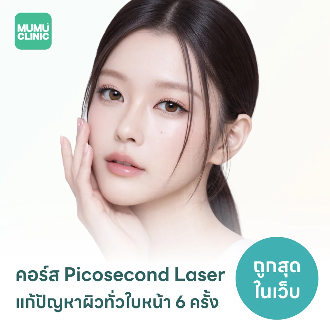 คอร์ส Picosecond Laser แก้ปัญหาผิวทั่วใบหน้า 6 ครั้ง