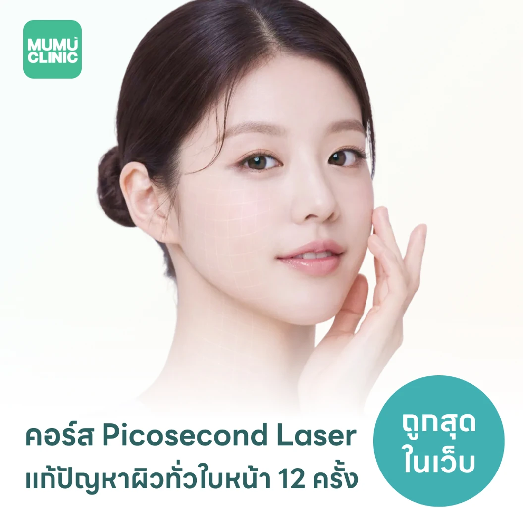 คอร์ส Picosecond Laser แก้ปัญหาผิวทั่วใบหน้า 12 ครั้ง