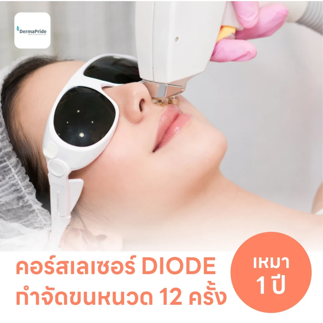 คอร์สเลเซอร์กำจัดขนหนวด 12 ครั้ง ด้วย Diode Laser