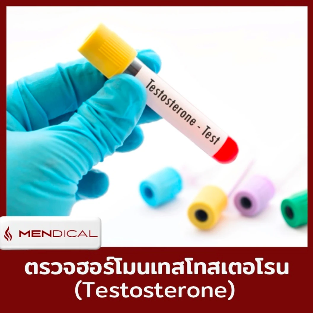 ตรวจฮอร์โมนเทสโทสเตอโรน (Testosterone) และตรวจสุขภาพเพศชาย 8 รายการ (40 ปีขึ้นไป เจาะเลือด)