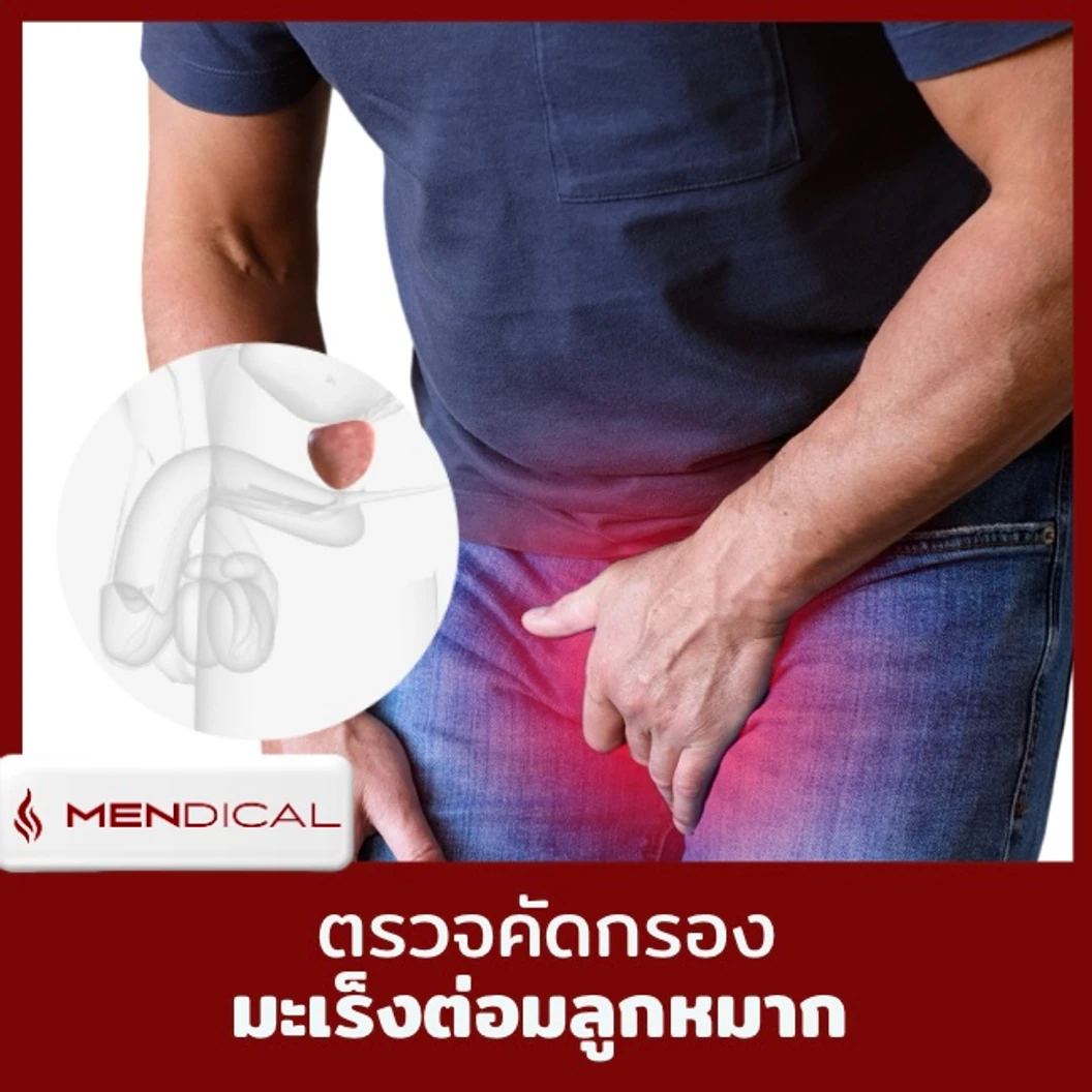 ตรวจฮอร์โมนเทสโทสเตอโรน (Testosterone) และตรวจสุขภาพเพศชาย 9 รายการ รวมตรวจคัดกรองมะเร็งต่อมลูกหมาก (40 ปีขึ้นไป เจาะเลือด)