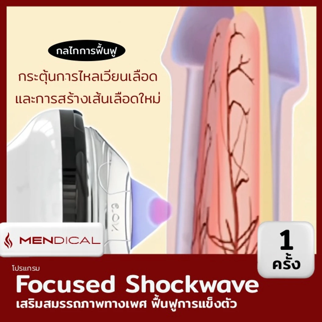 โปรแกรมเสริมสมรรถภาพทางเพศ กระตุ้นการไหลเวียนเฉพาะจุด ด้วย Focused Shockwave Therapy จำนวนช็อตขึ้นอยู่กับแพทย์ประเมิน (1 สิทธิ์/คน)