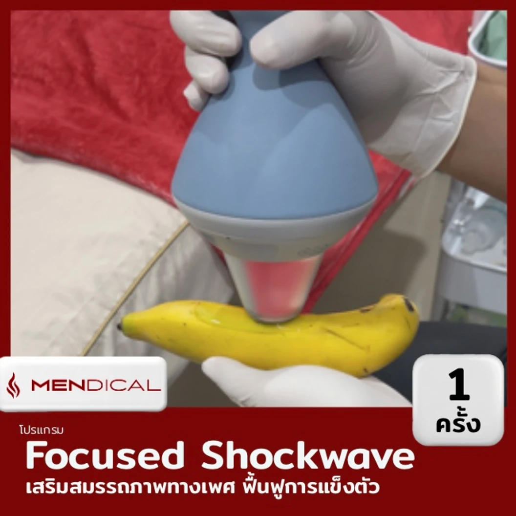 โปรแกรมเสริมสมรรถภาพทางเพศ กระตุ้นการไหลเวียนเฉพาะจุด ด้วย Focused Shockwave Therapy จำนวนช็อตขึ้นอยู่กับแพทย์ประเมิน (1 สิทธิ์/คน)