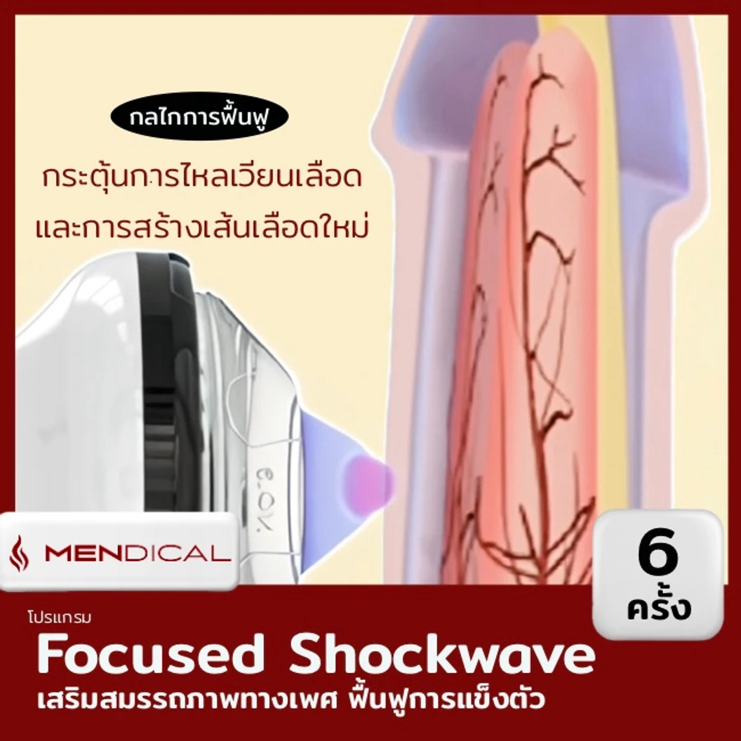 โปรแกรมเสริมสมรรถภาพทางเพศ กระตุ้นการไหลเวียนเฉพาะจุด ด้วย Focused Shockwave Therapy จำนวนช็อตขึ้นอยู่กับแพทย์ประเมิน 6 ครั้ง (เฉพาะวันศุกร์ 12.00-16.00 น.)