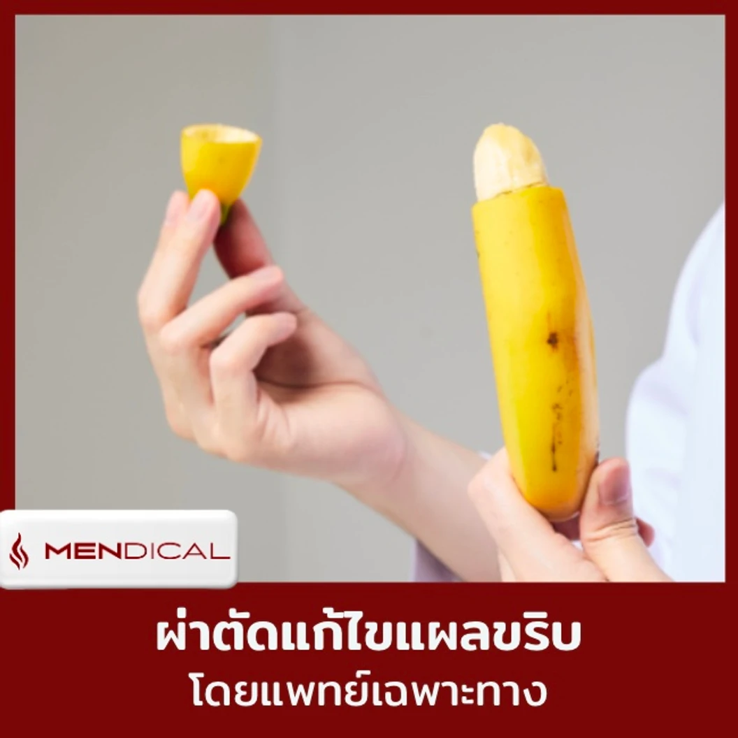 ผ่าตัดแก้ไขแผลขริบ เทคนิคขึ้นอยู่กับแพทย์ประเมิน