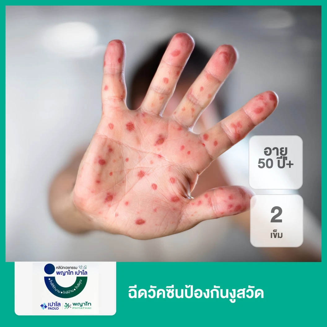 ฉีดวัคซีนป้องกันงูสวัด 2 เข็ม (50 ปีขึ้นไป)