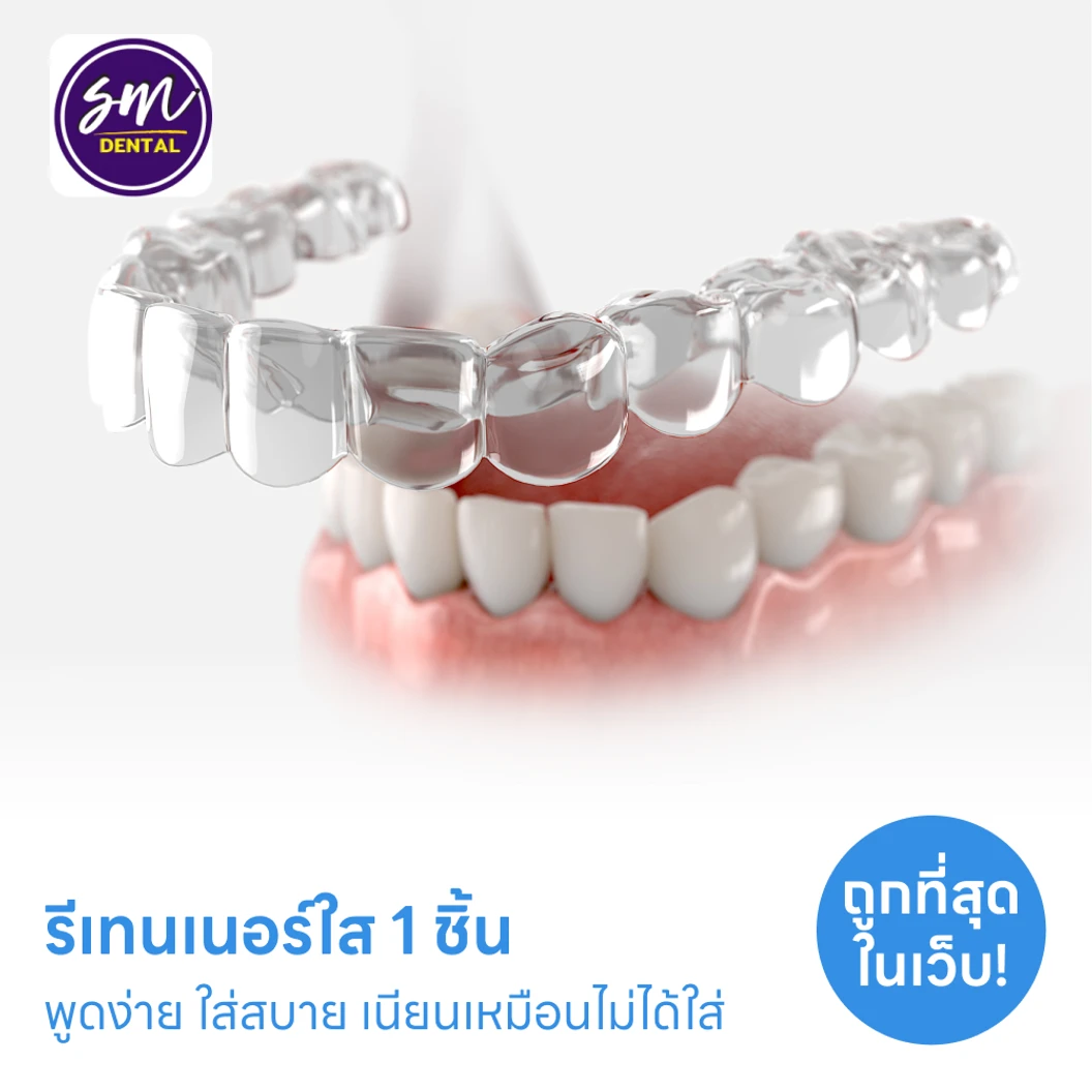 ทำรีเทนเนอร์แบบใส 1 ชิ้น