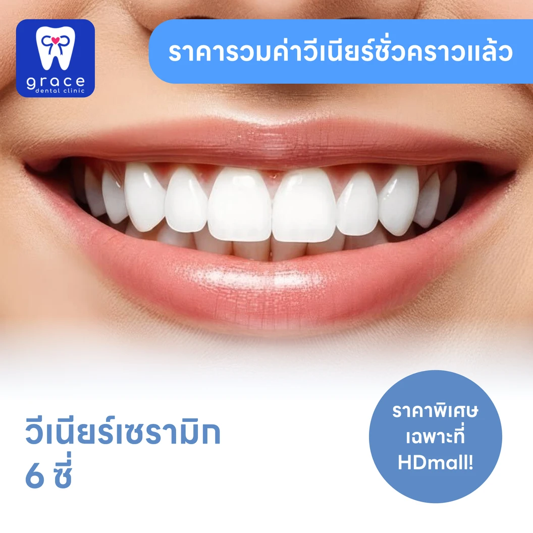 ทำวีเนียร์เซรามิก E-Max Press 6 ซี่