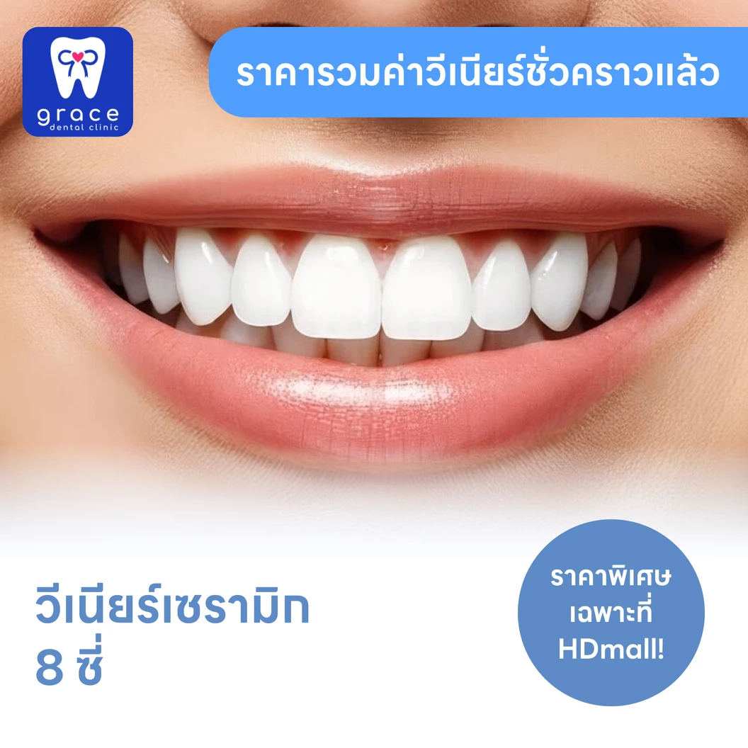 ทำวีเนียร์เซรามิก E-Max Press 8 ซี่