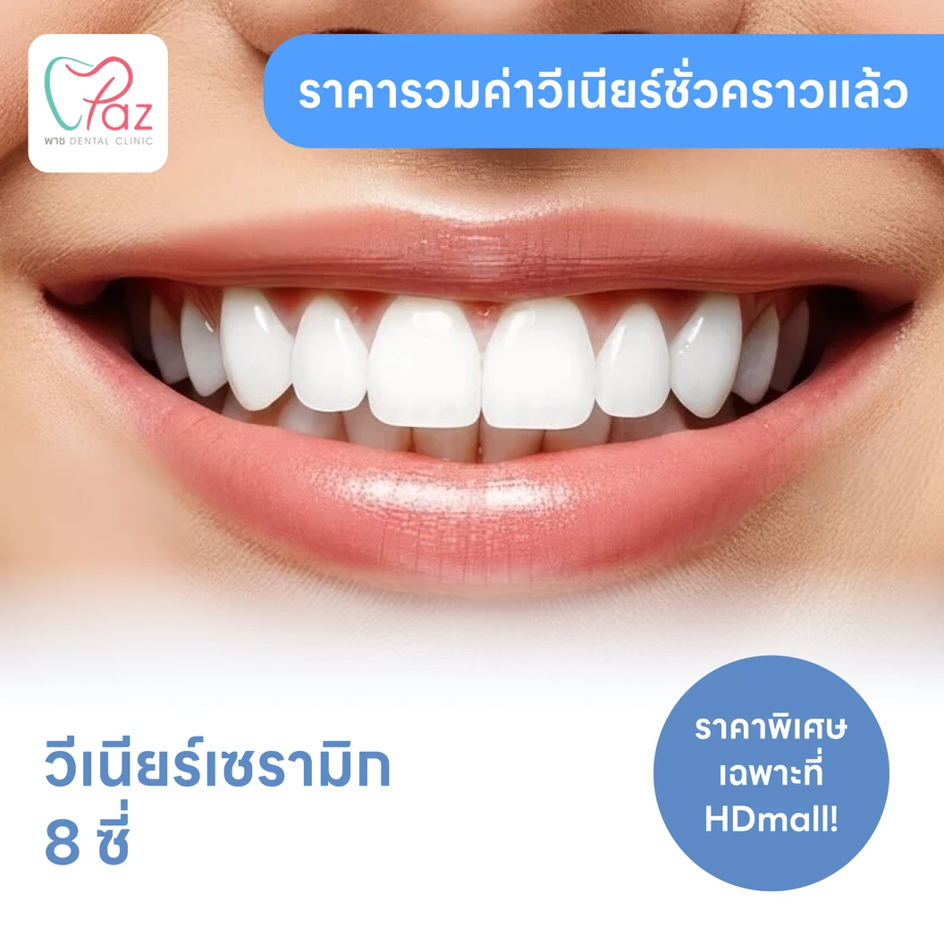 ทำวีเนียร์เซรามิก E-Max 8 ซี่