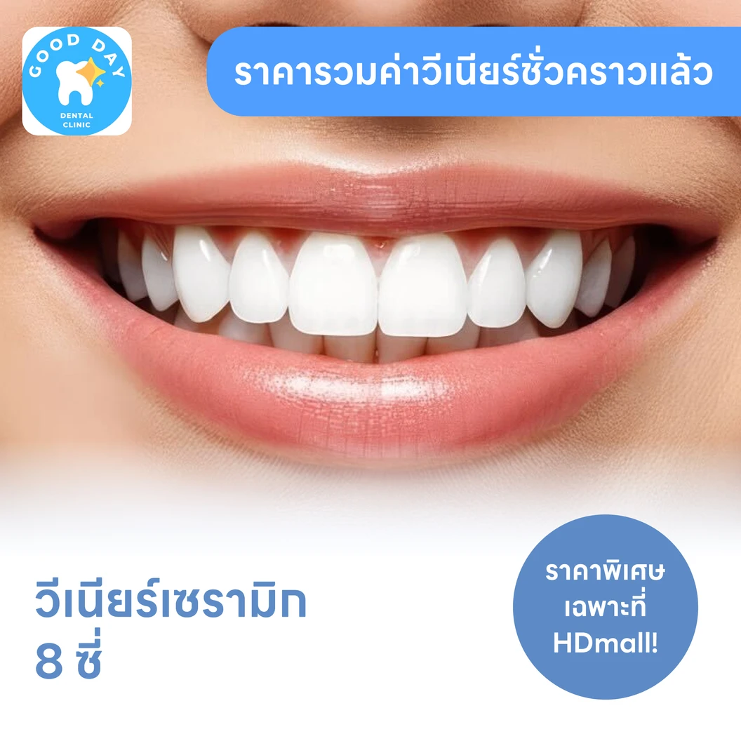 ทำวีเนียร์เซรามิก E-Max 8 ซี่