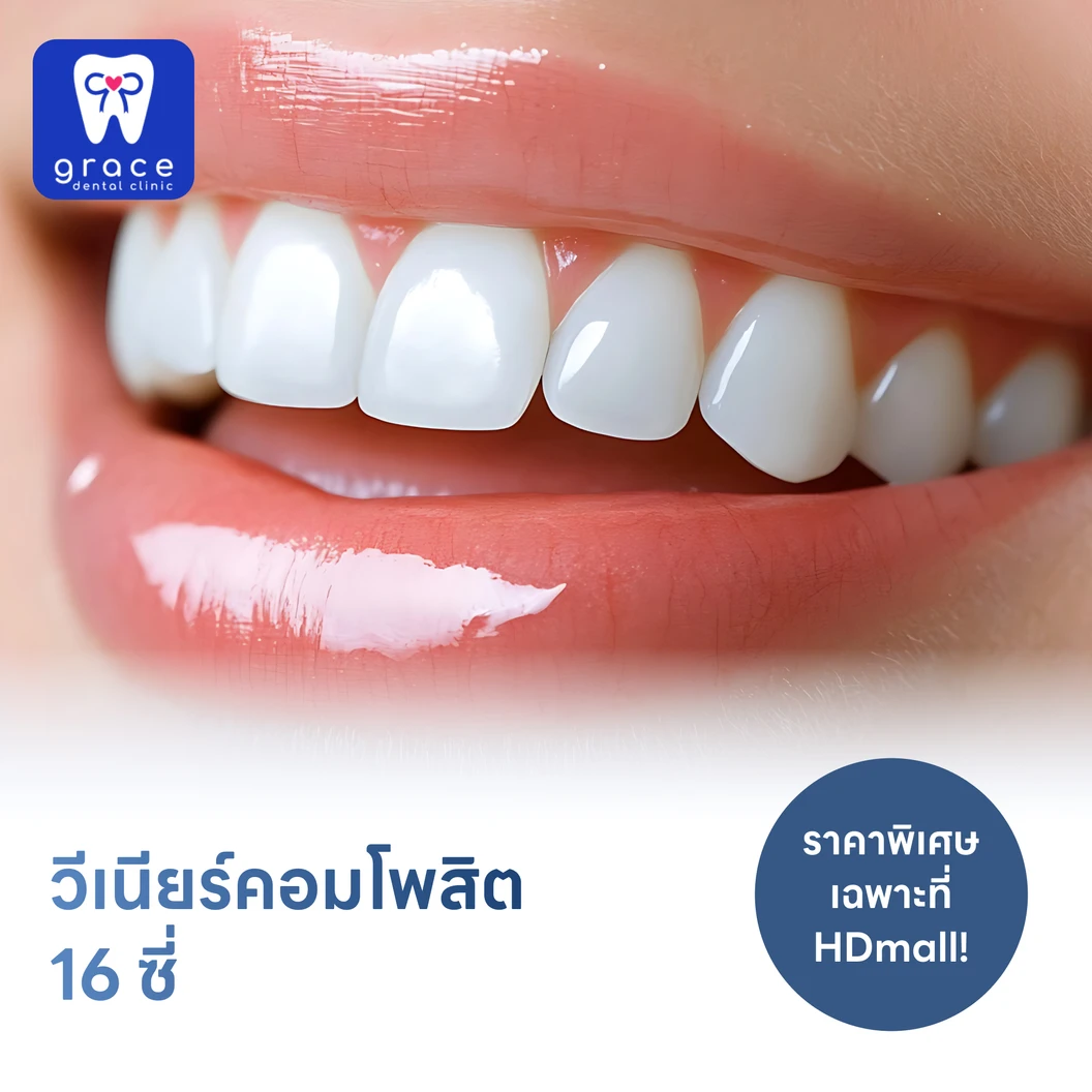 ทำวีเนียร์คอมโพสิต 16 ซี่