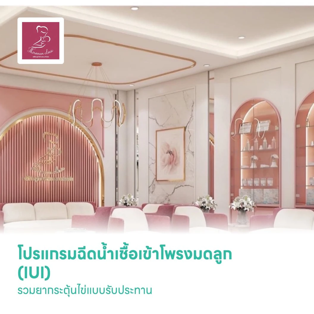 โปรแกรมฉีดน้ำเชื้อเข้าโพรงมดลูก (IUI) รวมยากระตุ้นไข่แบบรับประทาน