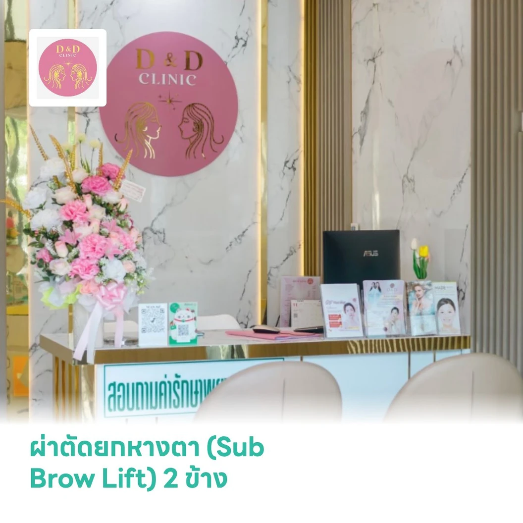 ผ่าตัดยกหางตา (Sub Brow Lift) 2 ข้าง