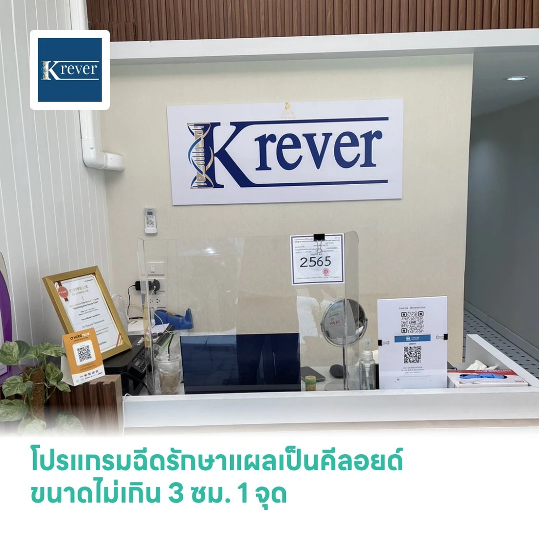 โปรแกรมฉีดรักษาแผลเป็นคีลอยด์ ขนาดไม่เกิน 3 ซม. 1 จุด