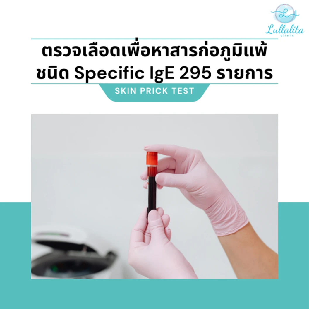ตรวจสารก่อภูมิแพ้ชนิด Specific IgE แบบ Multiplex 295 รายการ (ทุกช่วงวัย เจาะเลือด)