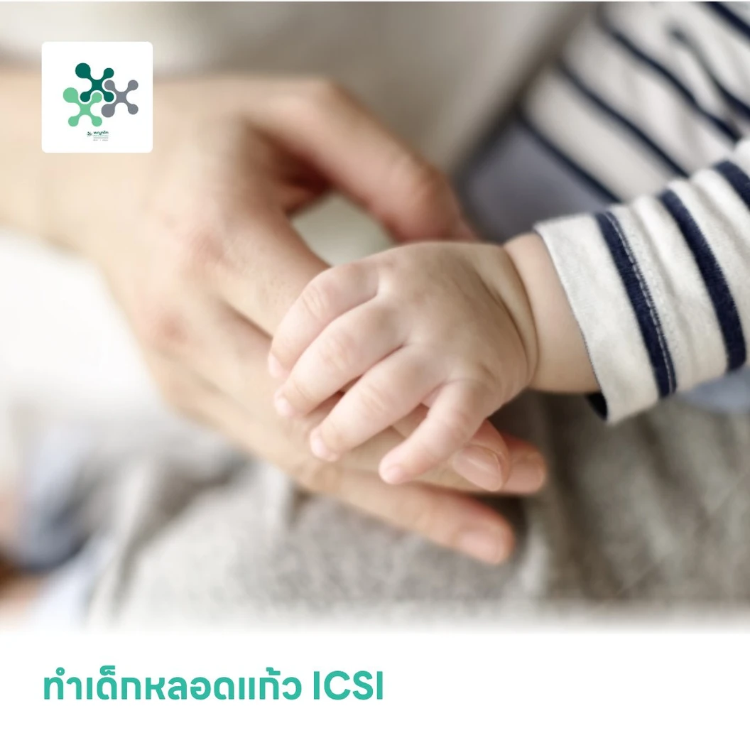 ทำเด็กหลอดแก้ว ICSI