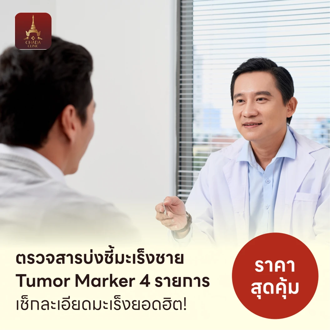 ตรวจสารบ่งชี้มะเร็งชาย Tumor Marker 4 รายการ
