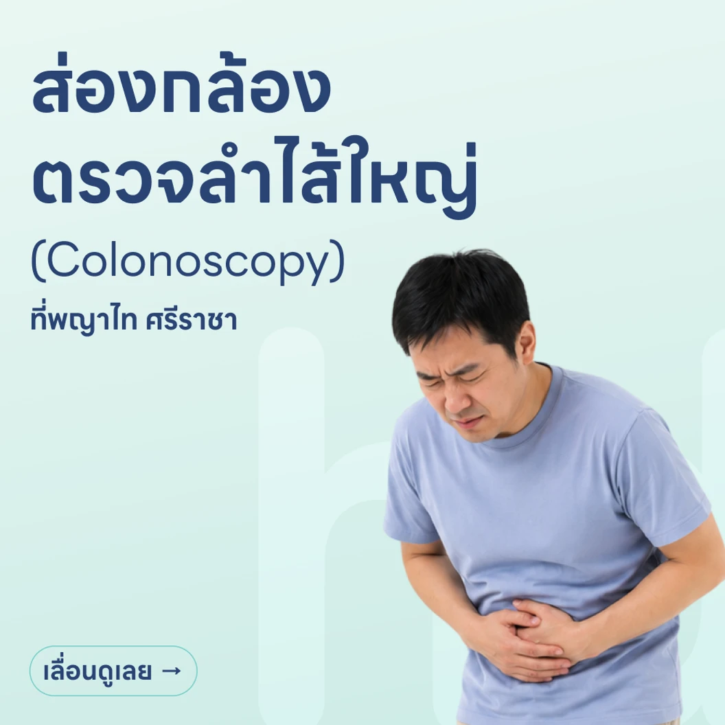 ส่องกล้องตรวจลำไส้ใหญ่ (Colonoscopy)