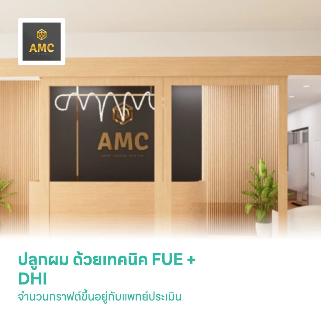 ปลูกผม ด้วยเทคนิค FUE + DHI จำนวนกราฟต์ขึ้นอยู่กับแพทย์ประเมิน