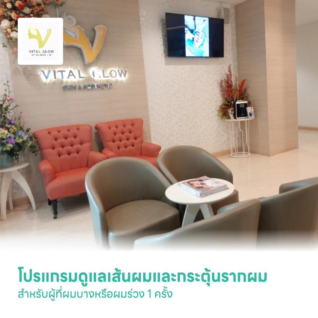 โปรแกรมดูแลเส้นผมและกระตุ้นรากผม ด้วยการฉีด Nacentech บำรุงรากผม สำหรับผู้ที่ผมบางหรือผมร่วง 1 ครั้ง