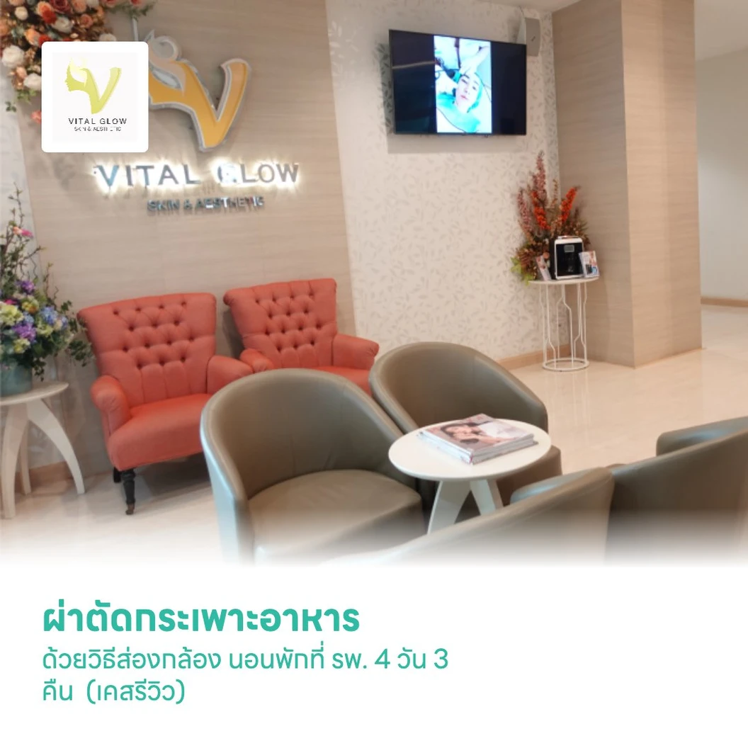 ผ่าตัดกระเพาะอาหาร ด้วยวิธีส่องกล้อง นอนพักที่ รพ. 4 วัน 3 คืน (เคสรีวิว)